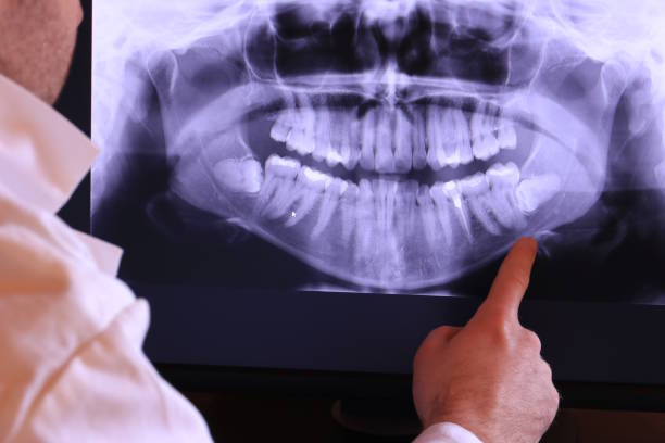 Best Chipped Tooth Repair Near Me  in Mountain Lake Park, MD